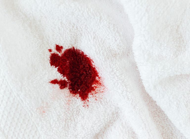 What’s the Difference Between Spotting and Periods?