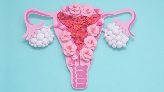 What is PCOS and How is it Related to Menstrual Irregularities?