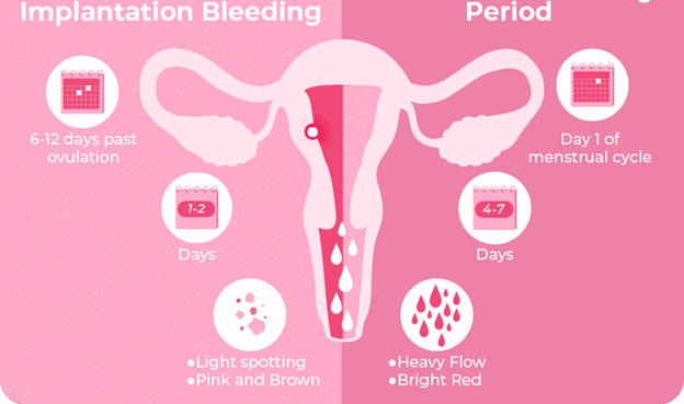 Implantation Bleeding: What Every Woman Needs to Know