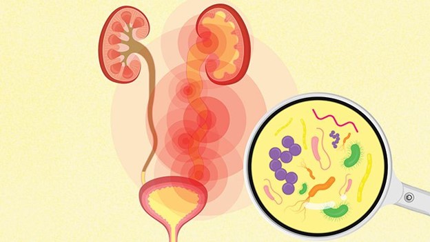 3 Reasons Why UTIs May Become More Common During Your Period