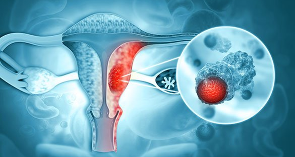 The Subtle Signs: 3 Unnoticed Symptoms of Reproductive Diseases in Women